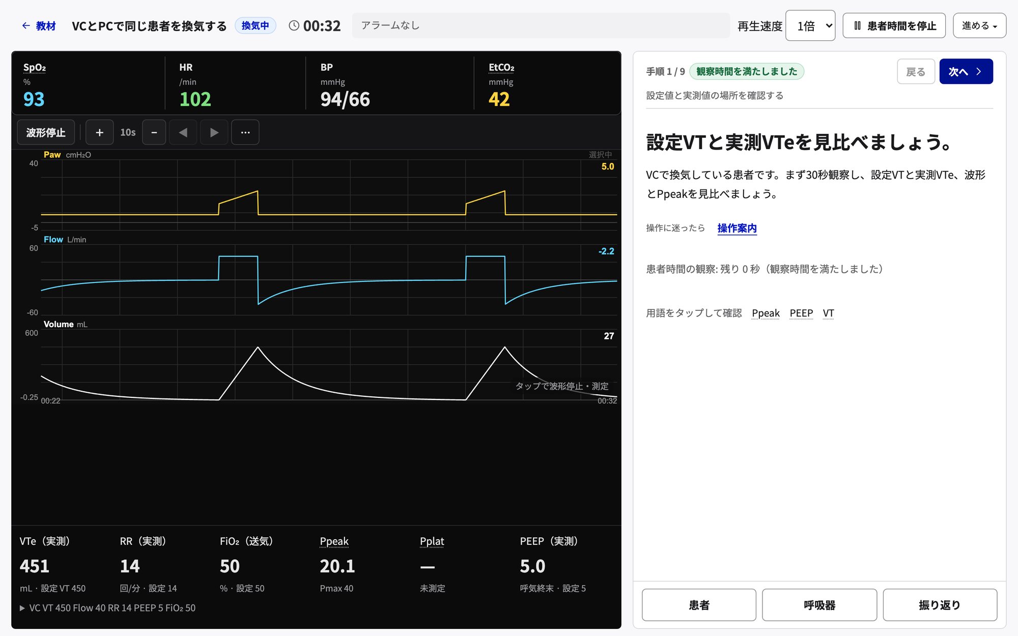 VentLoopの演習画面。上に経過時間・再生速度・患者時間を停止・進める、左にバイタルと圧・流量・換気量の波形と実測値、右に手順カード、下に患者・呼吸器・振り返りのボタン。