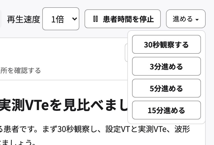 「進める」を開いたところ。30秒観察する、3分進める、5分進める、15分進める。
